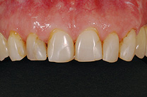 &Auml;sthetische Zahnmedizin