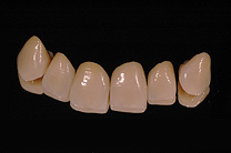 &Auml;sthetische Zahnmedizin