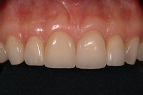 &Auml;sthetische Zahnmedizin